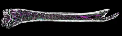Bone Marrow Tissue