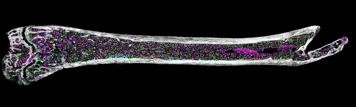 Quantitative Imaging and Spatial Analysis